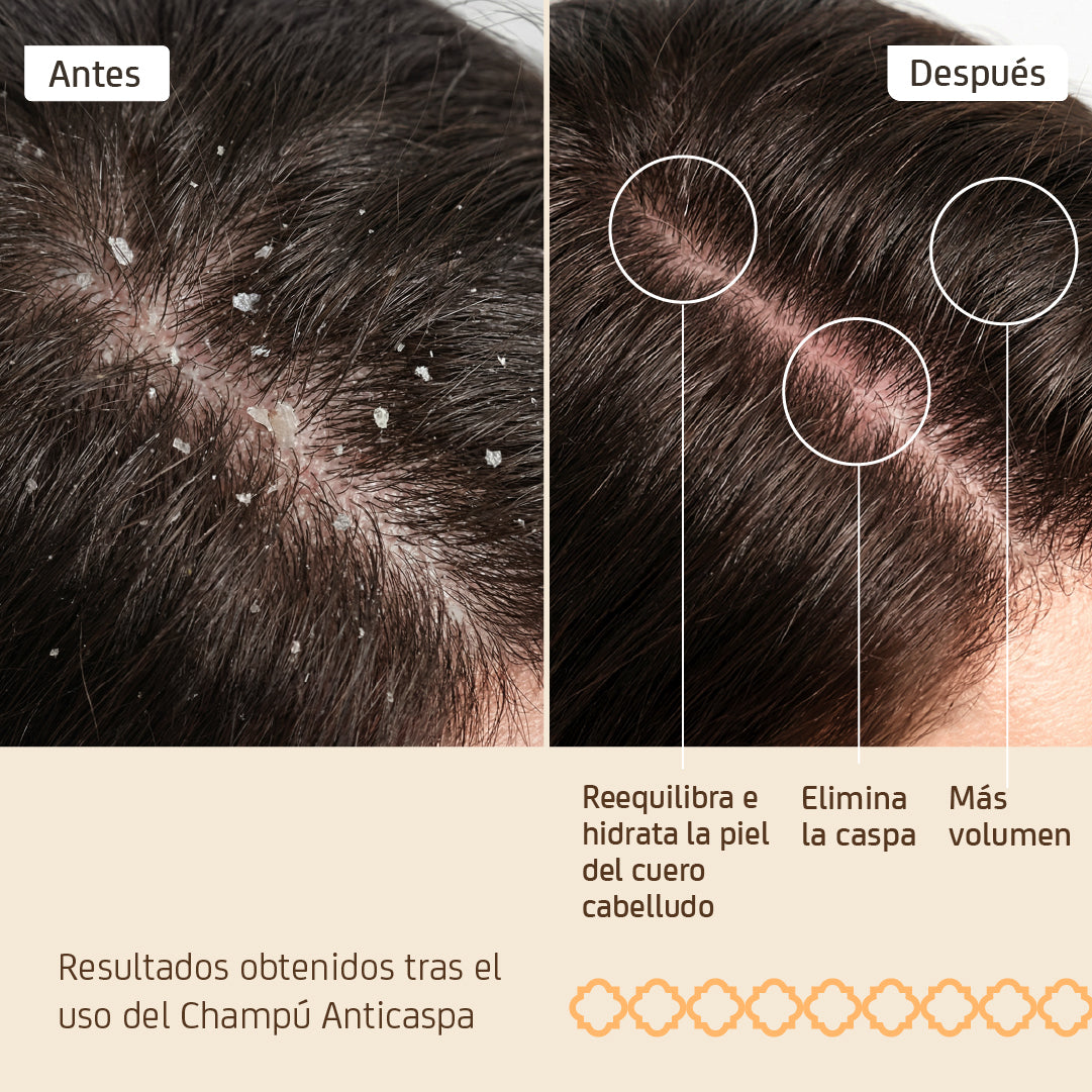 Shampoo Anti Caspa 250 ml