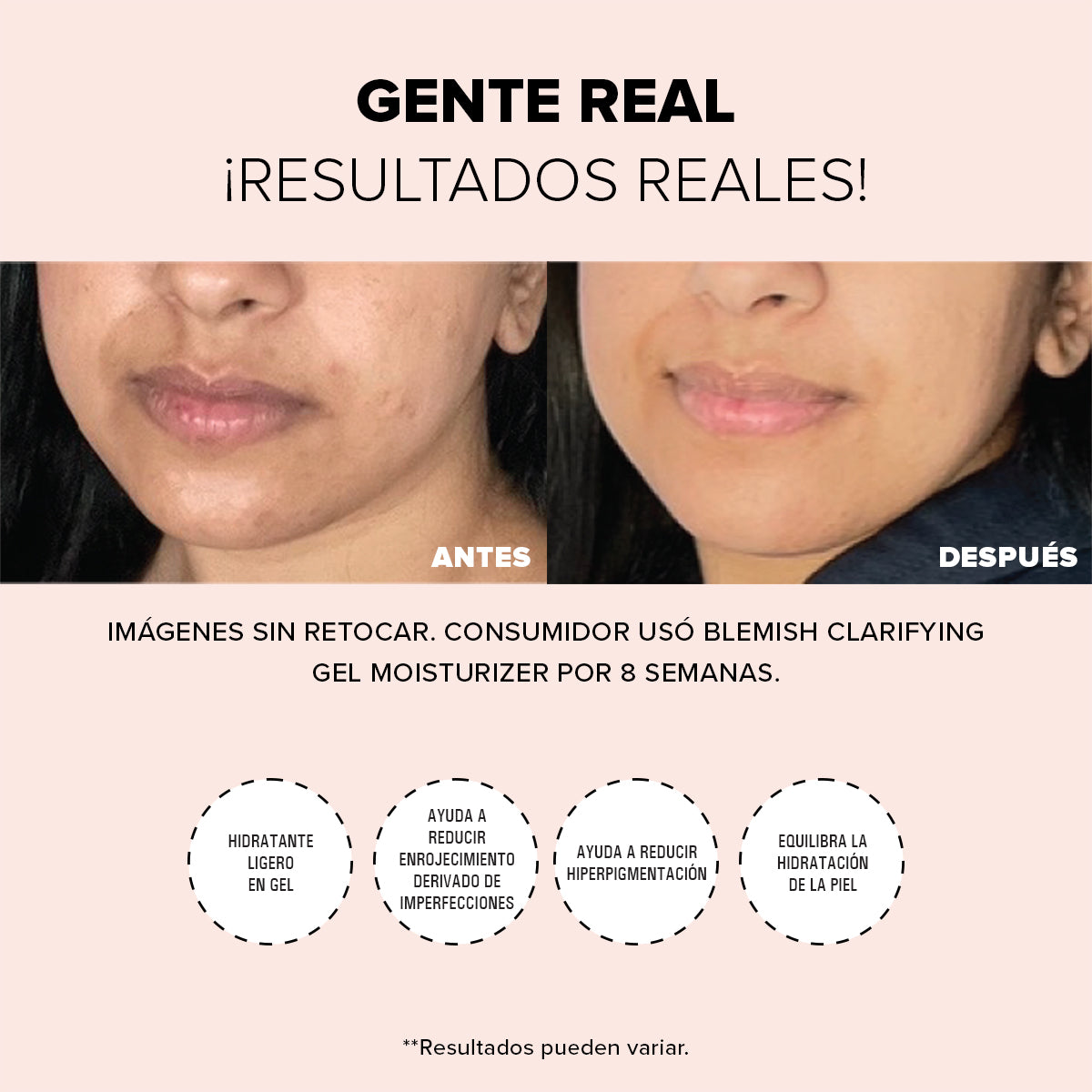 BLEMISH CLARIFYING GEL MOISTURIZER
